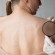 Spitalul Judeţean de Urgenţă Miercurea-Ciuc organizează screening gratuit pentru depistarea cancerului de piele