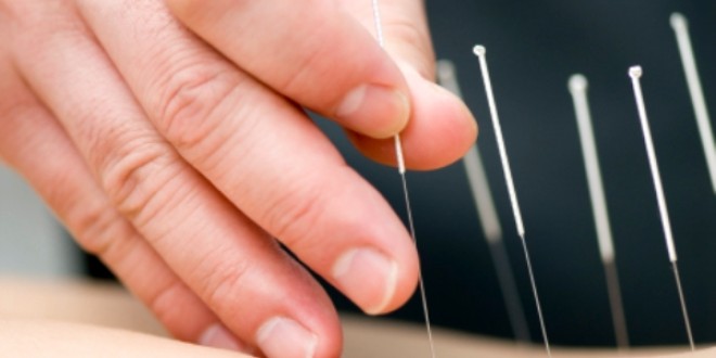 Casele de Asigurări de Sănătate decontează două tratamente de acupunctură pe an